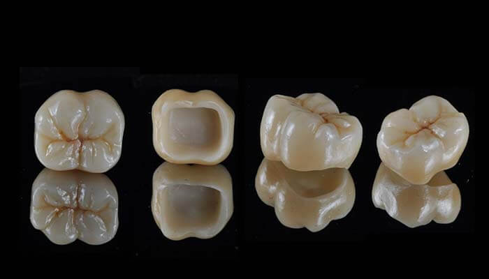 フルジルコニア