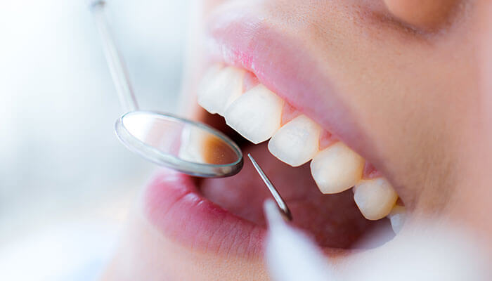 歯周ポケット診査、レントゲン撮影、口腔内写真撮影